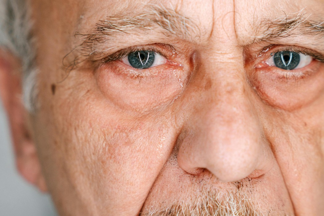 The Early Stages of Cataracts in Seniors
