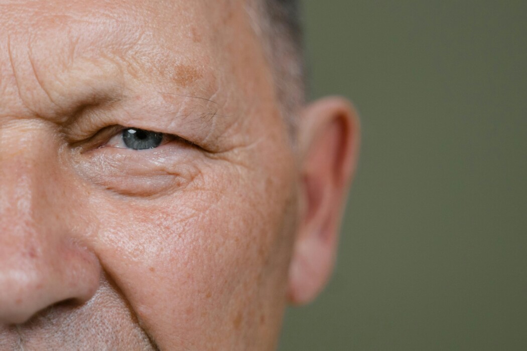 Why is Glaucoma More Prevalent in Seniors?