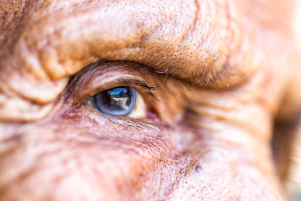 Treatment Options for Glaucoma in Seniors