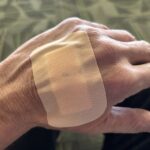Everyday Habits That Speed Up Wound Healing