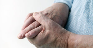 Making Everyday Life Easier with Arthritis