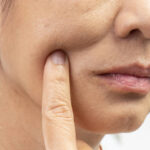 A Sore Mouth Can Have Several Causes