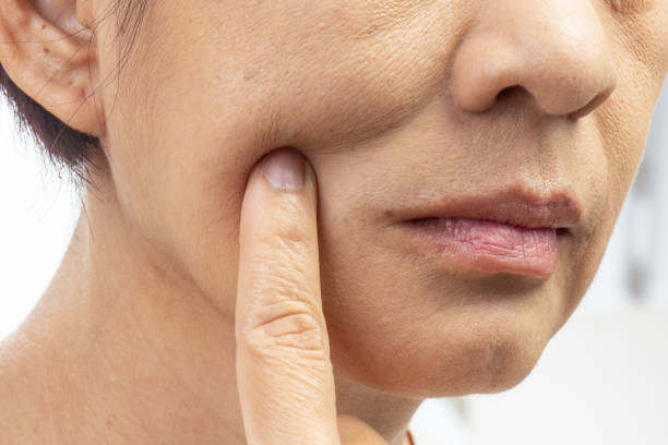 Dry Mouth Can Affect More Than Your Comfort
