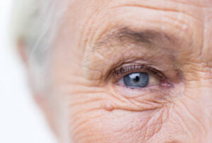 Keep Your Eyes Safe From Everyday Falls