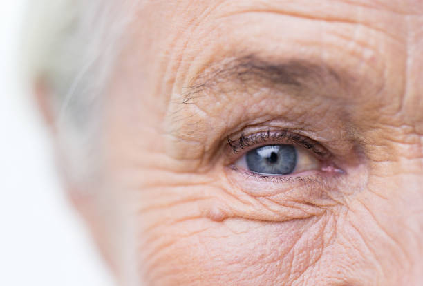 Keep Your Eyes Safe From Everyday Falls