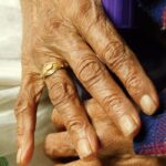 Travelling with Arthritis