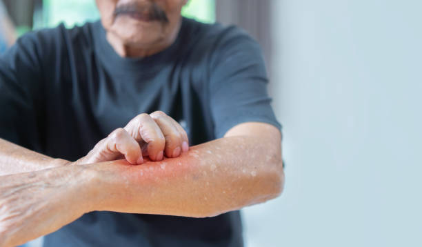 Why You Should Take Persistent Itching Seriously