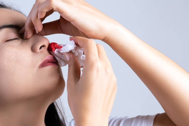 Another Nosebleed Before Breakfast?