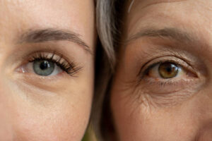 Keep an Eye on Changes to Your Skin