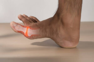 That Sudden Pain in Your Big Toe Could Be Gout
