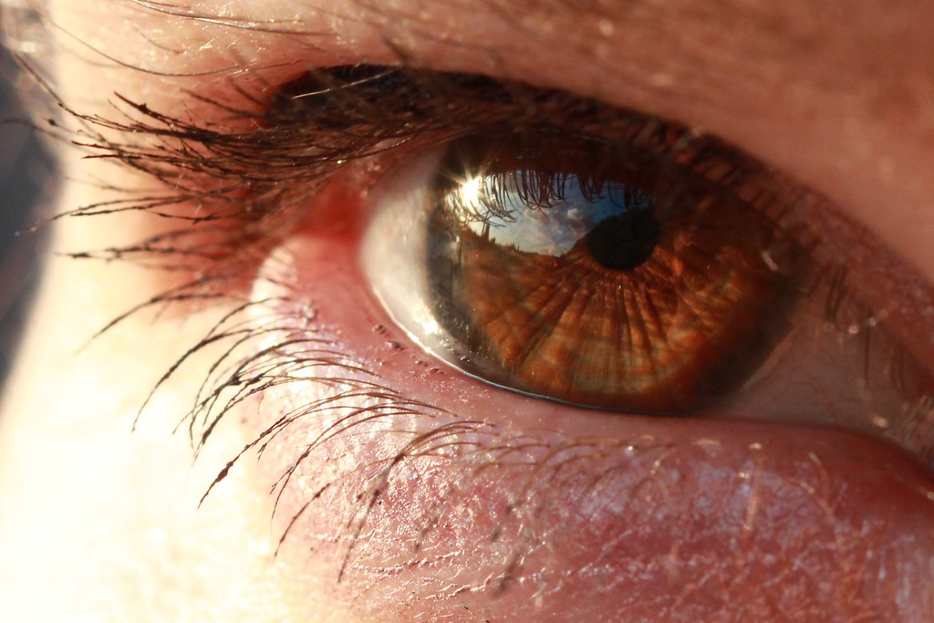 When Your Eyes Feel Dry and Irritated