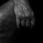 Wound Not Healing? What NZ Seniors Should Do After Two Weeks