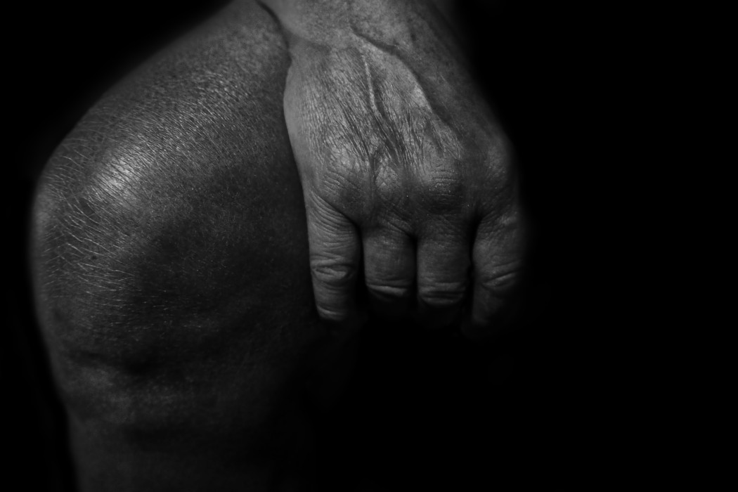 Wound Not Healing? What NZ Seniors Should Do After Two Weeks