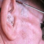 Hearing Aids Can Make Air Travel Easier