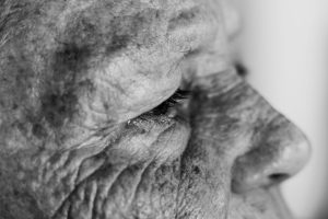 Melanoma Symptoms Explained for Seniors