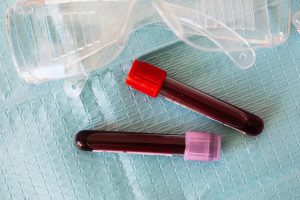 Why Iron Deficiency in Seniors Is Often Missed