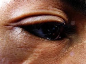 Why Your Eyes Water Even When You’re Not Crying